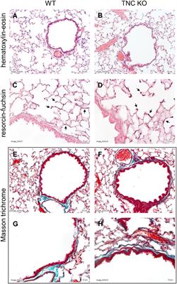 Tenascin-C: Friend or Foe in Lung Aging?